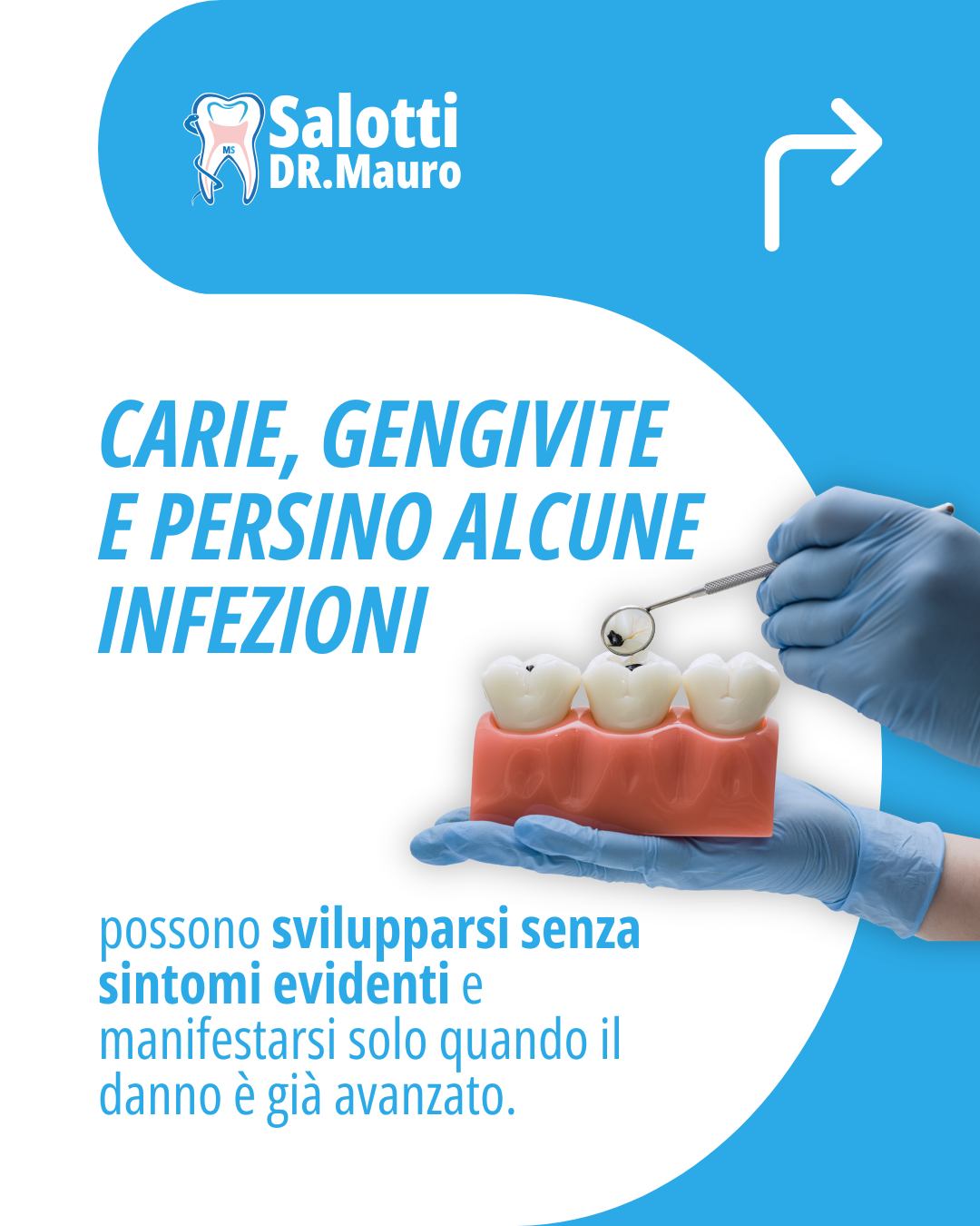 ❌ Vero o Falso?
"Se un dente non fa male, significa che è sano."
FALSO.
Il dolore è spesso un segnale tardivo. Molte patologie della bocca, come carie, gengiviti o problemi ai denti, possono svilupparsi senza dare alcun fastidio nelle fasi iniziali.
Per questo motivo è importante non aspettare che compaia il dolore per prenotare una visita.
🦷 Un controllo periodico permette di individuare eventuali problemi quando sono ancora piccoli, rendendo le cure più semplici, rapide e meno invasive.
💬 Tu ogni quanto fai un controllo dal dentista? Scrivilo nei commenti!
📩 Se è passato troppo tempo dall'ultima visita, contattaci e prenota il tuo controllo.
#veroofalso #dentista #prevenzione #saluteorale #carie #gengivite #igieneorale #controllodentista #sorrisosano #odontoiatria